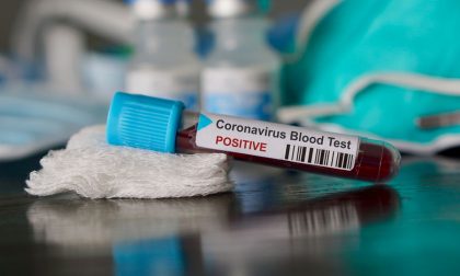 Coronavirus, solo 8 decessi registrati