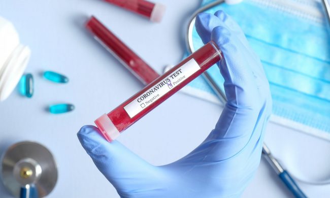 Coronavirus, altri 16 decessi di persone risultate positive in Piemonte