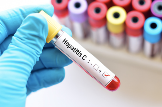 Epatite C, riconoscerla e curarla: lo screening gratuito in Piemonte