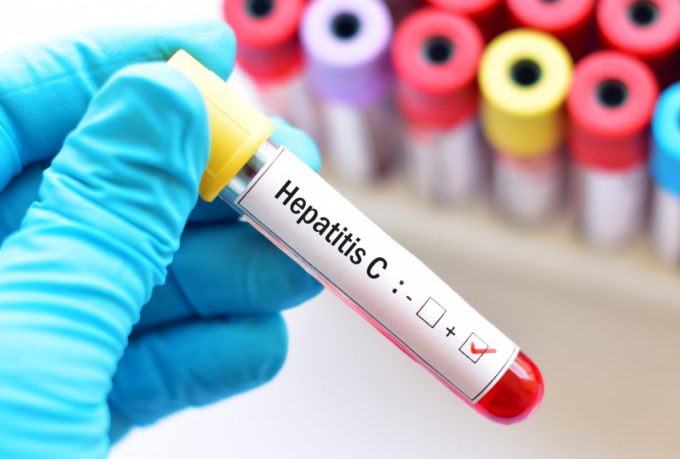 Da domani screening gratuiti per l’epatite C