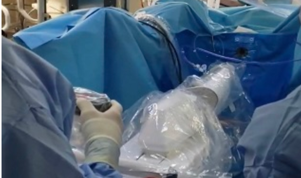 La play station entra in sala operatoria: ecco perché