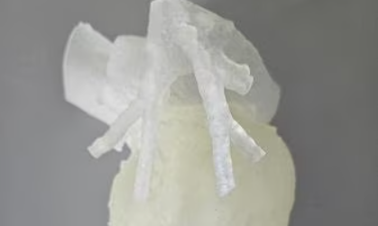 Chirurghi ed ingegneri insieme per un intervento al cuore senza precedenti