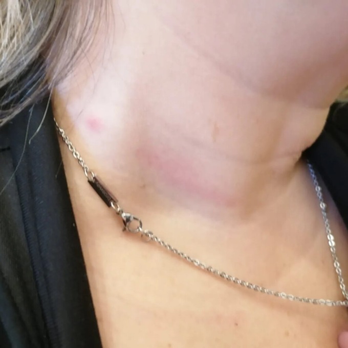 Aggredita e minacciata per una foto