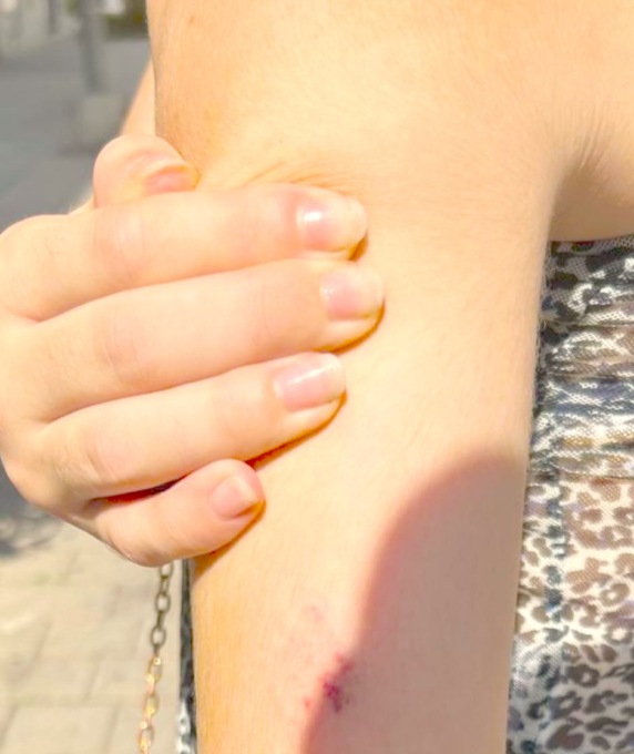 Morsicata da un cane in pieno centro cittadino