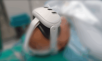 Tumore alla prostata, interventi laser alle Molinette con realtà virtuale