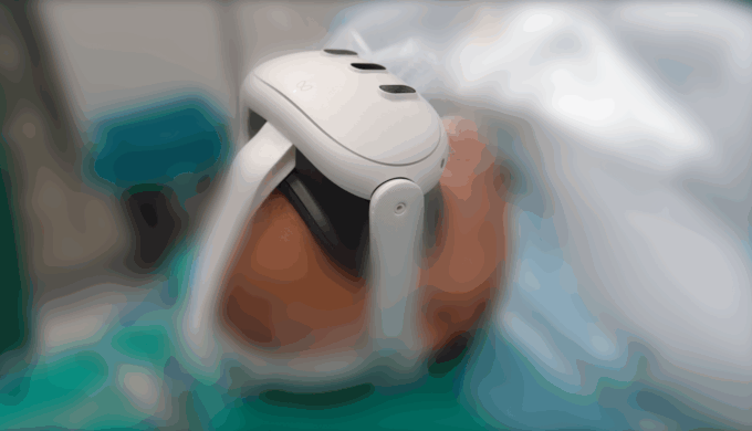 Tumore alla prostata, interventi laser alle Molinette con realtà virtuale