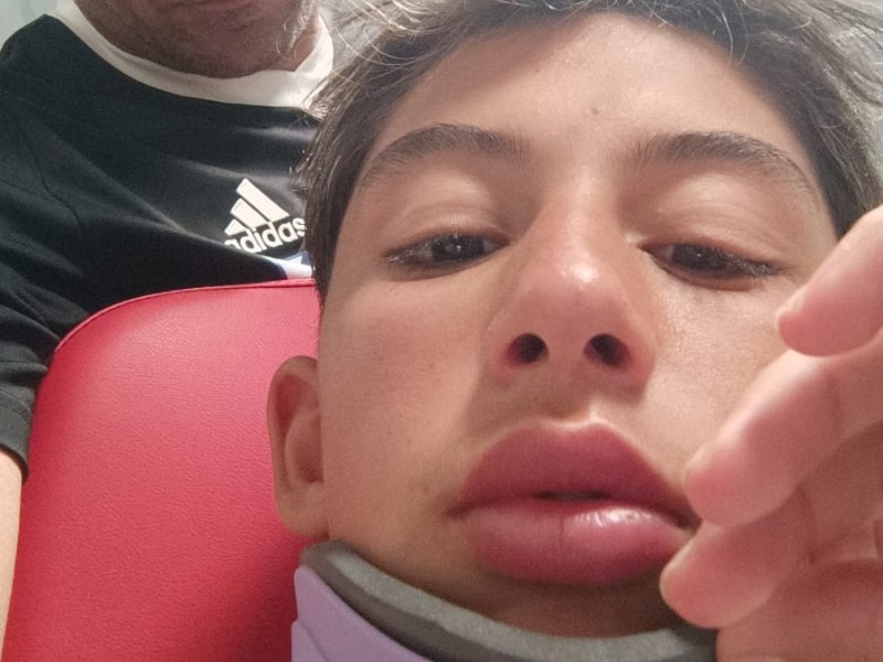 Portiere aggredito da un papà e squalificato per un anno, il padre: “Assurdo”